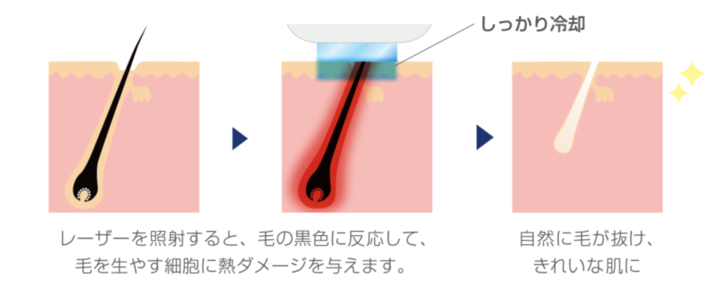 フォーマアルファの特長
