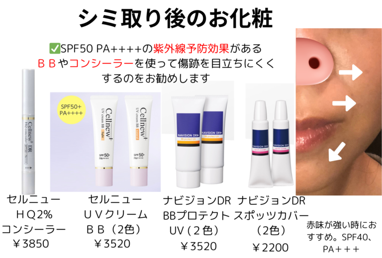 シミ取り後のお化粧