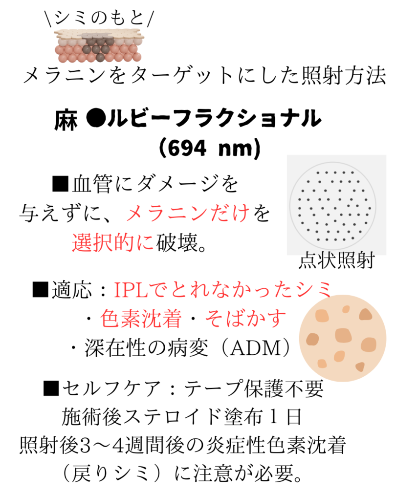 ディスカバリーピコレーザーの詳しい内容