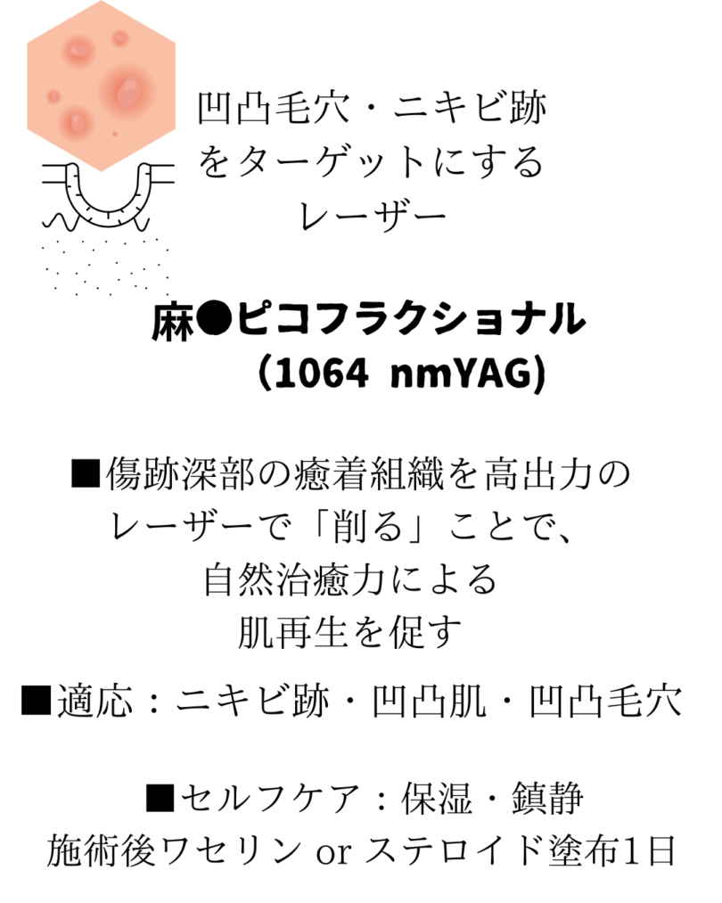 ディスカバリーピコレーザーの詳しい内容