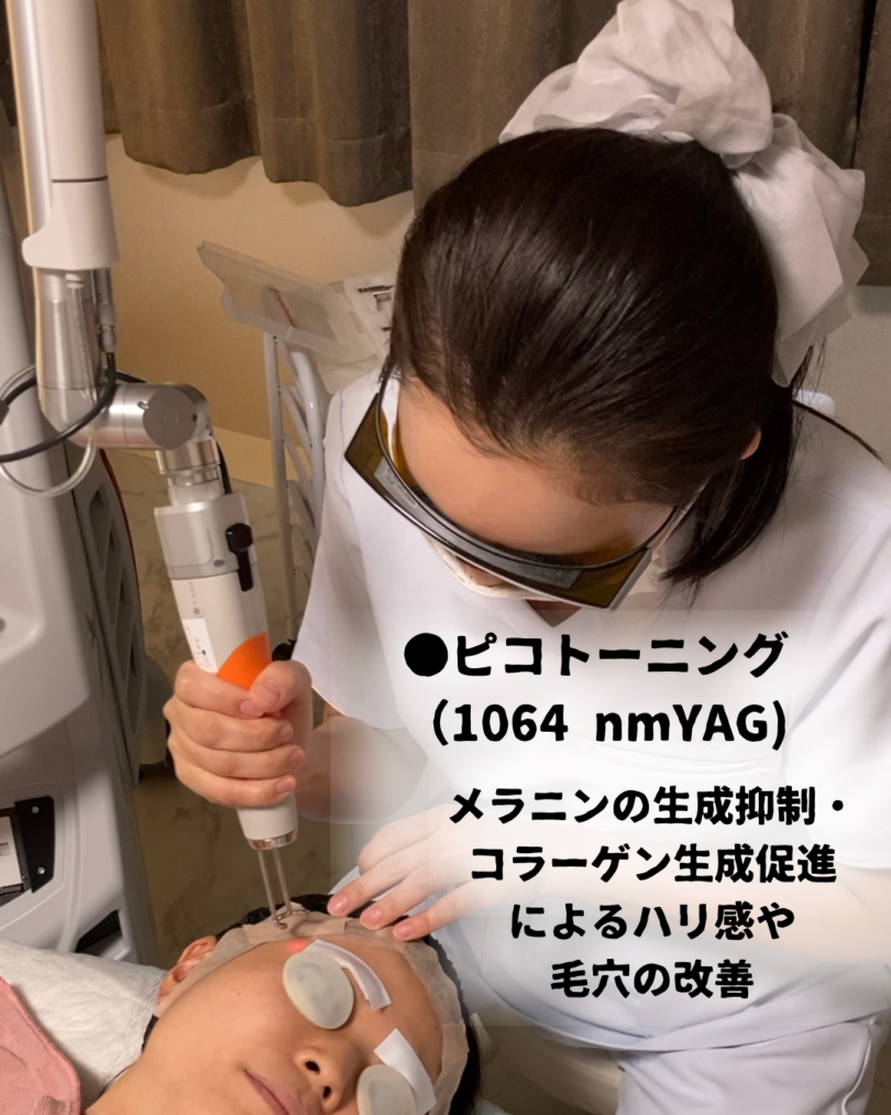 ディスカバリーピコレーザーの詳しい内容