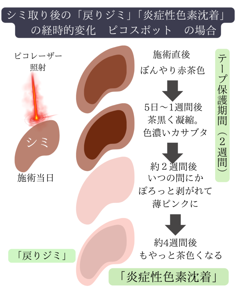 ディスカバリーピコレーザーの詳しい内容