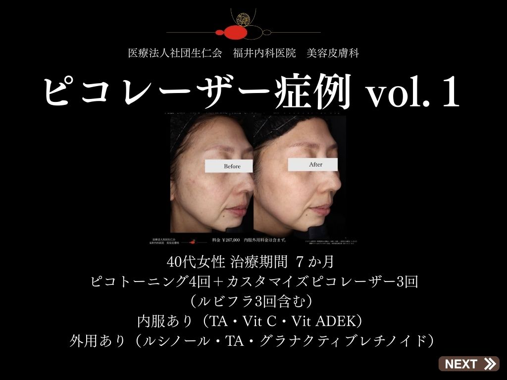 症例集