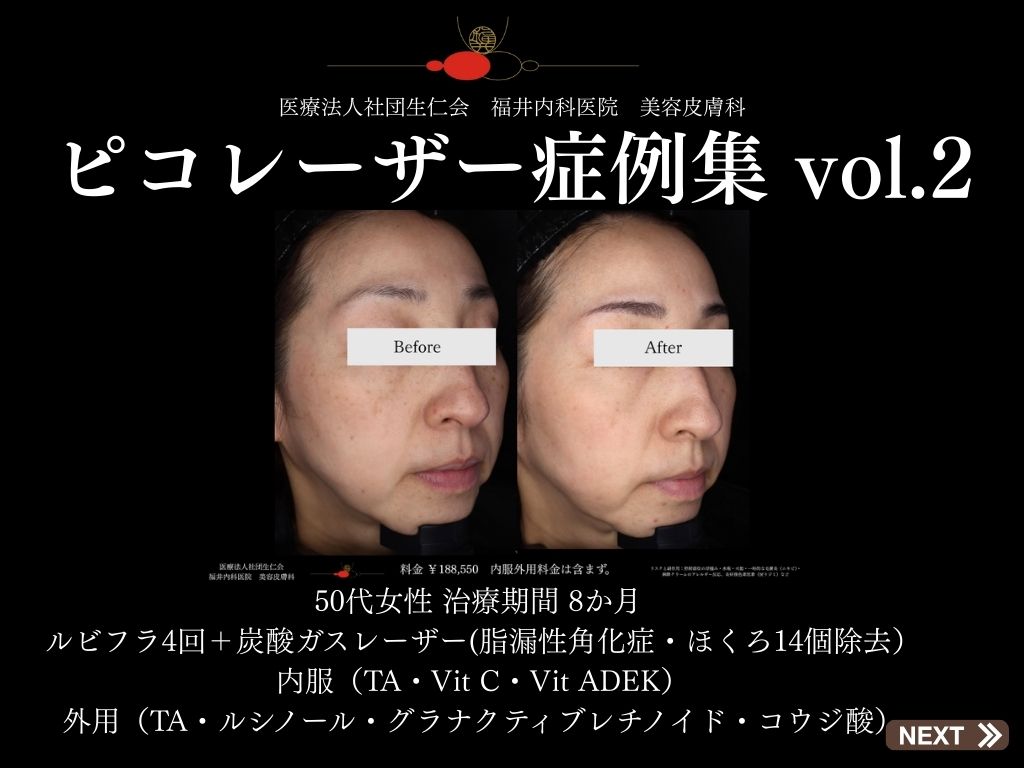 症例集