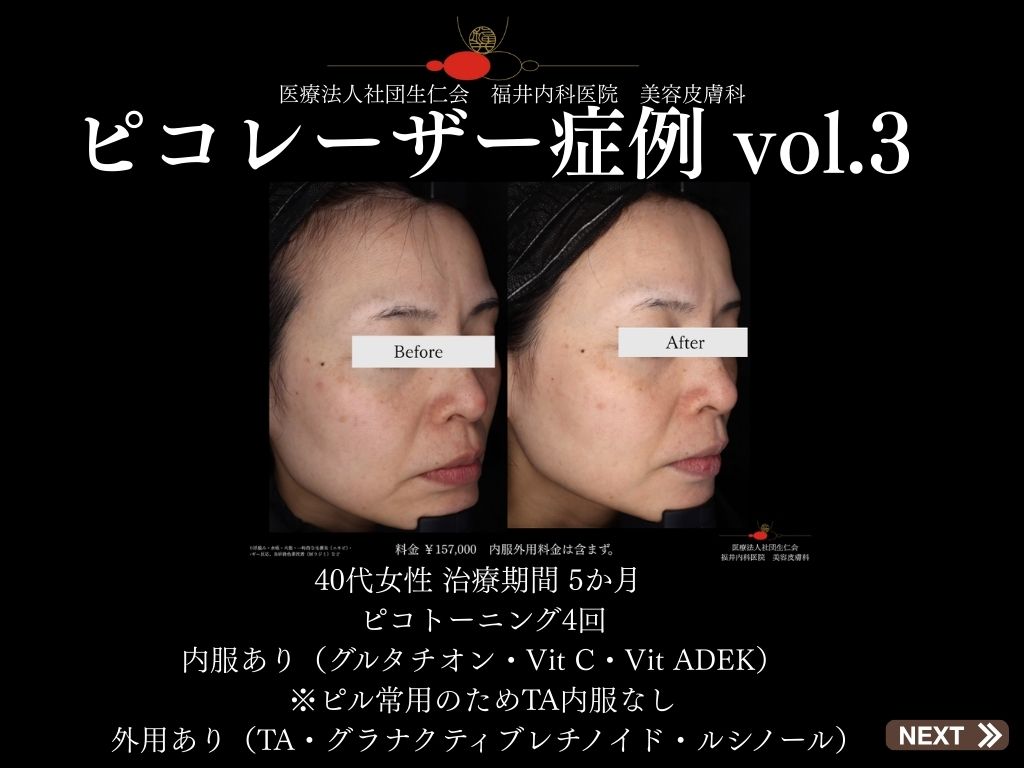 症例集
