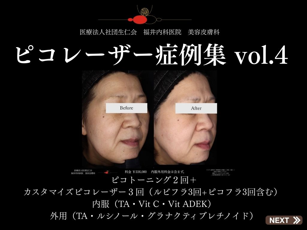 症例集
