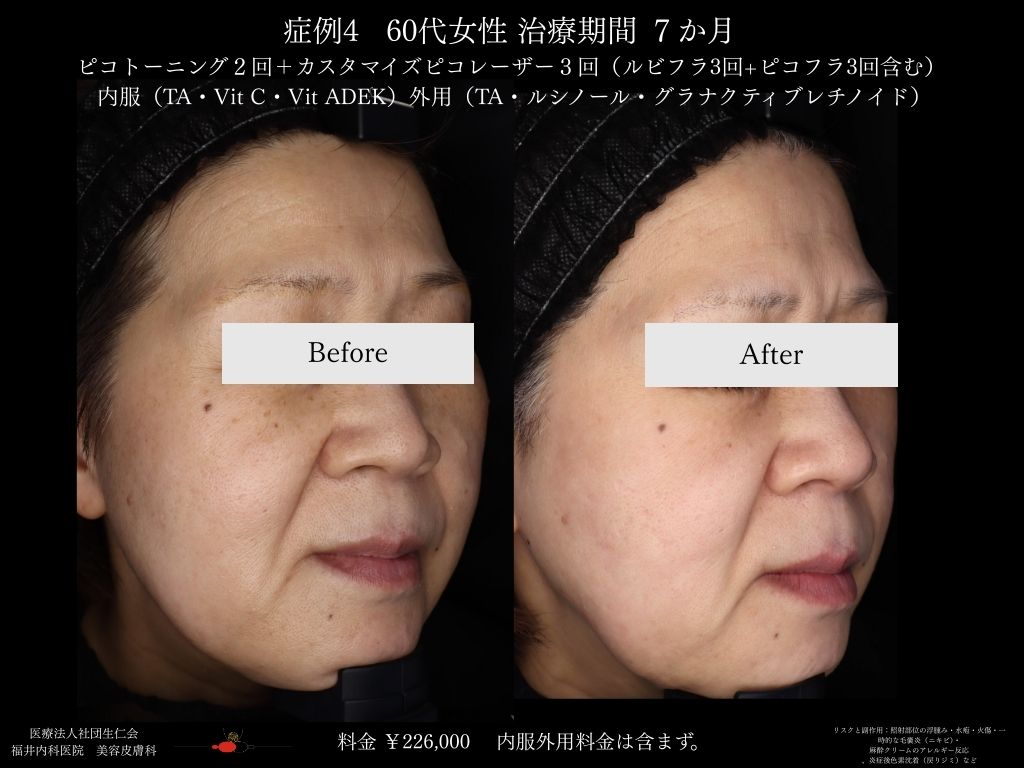 症例集