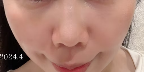 ​施術前