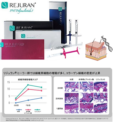 PN製剤（ポリヌクレオチド）リジュラン®注射とは？
