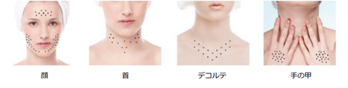 リジュラン®注射の施術適応部位